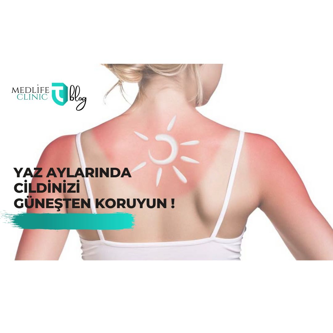 Marmaris Güneş Lekesi Medlife Clinic Dr. Tuba Kavala Bilgilendiriyor